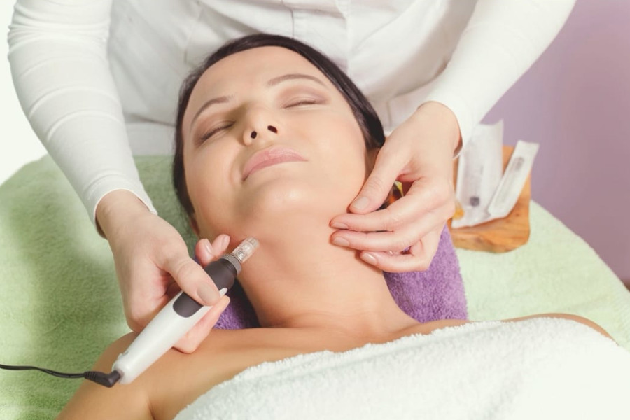 Mikro-Needling
